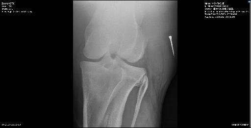 Right Stifle Caudal Cranial
